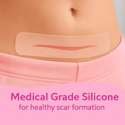 Transparent C-Section Silicone Scar Strips - Pack of 6