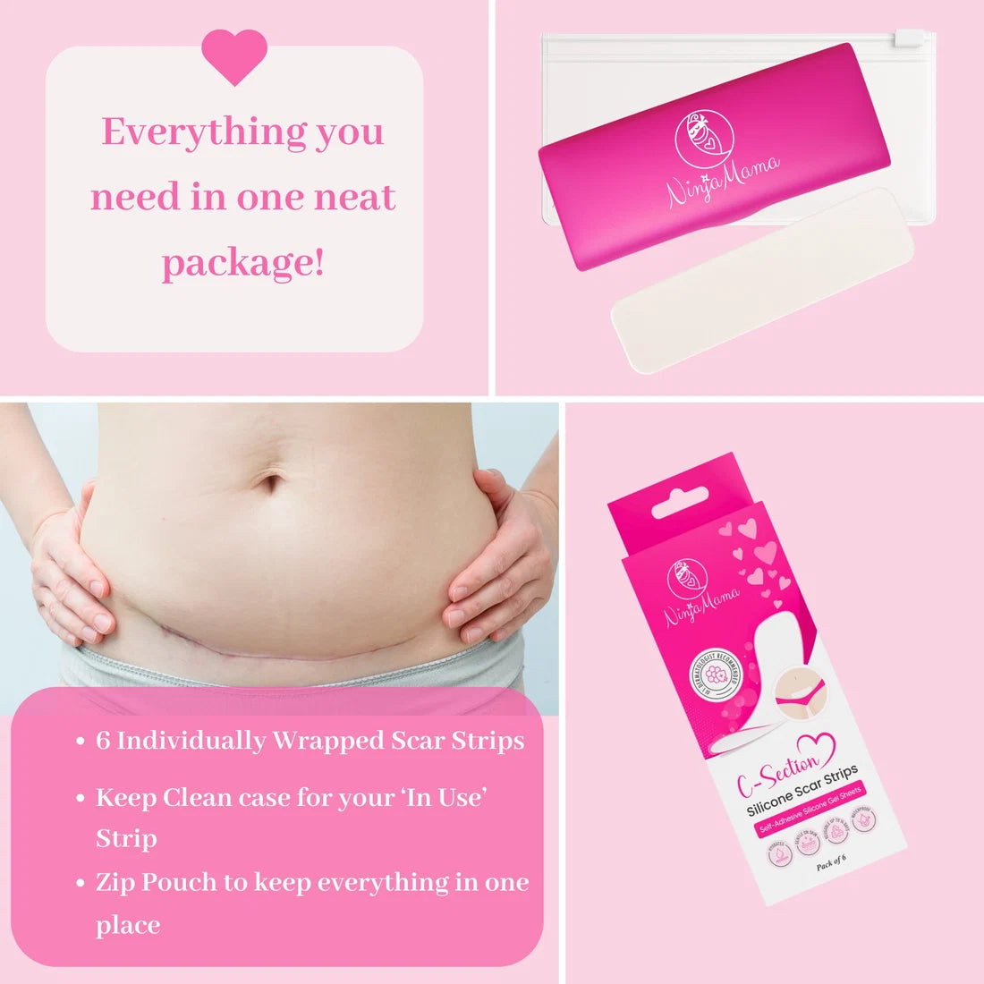 Transparent C-Section Silicone Scar Strips - Pack of 6